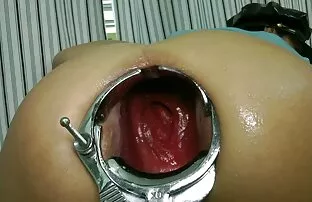 - Elbow Deep Fisting Prolapse Speculum Extreme